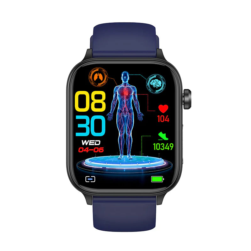 ECG BLOOD GLUCOSE INTELLIGENT MICRO-PHYSICAL EXAMINATION STRESS MONITORING SMARTWATCH