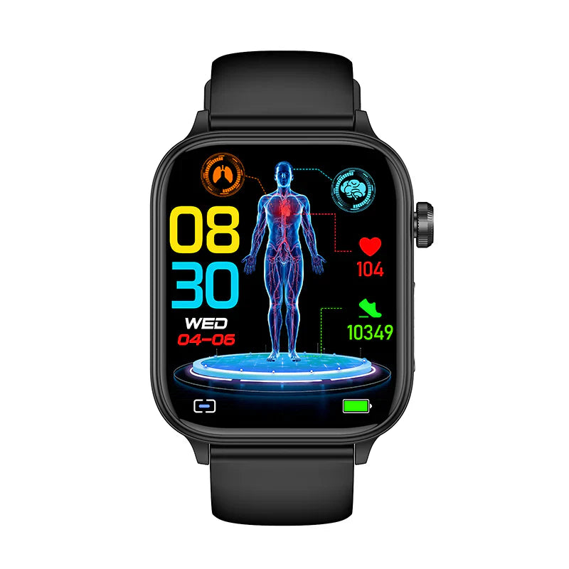 ECG BLOOD GLUCOSE INTELLIGENT MICRO-PHYSICAL EXAMINATION STRESS MONITORING SMARTWATCH